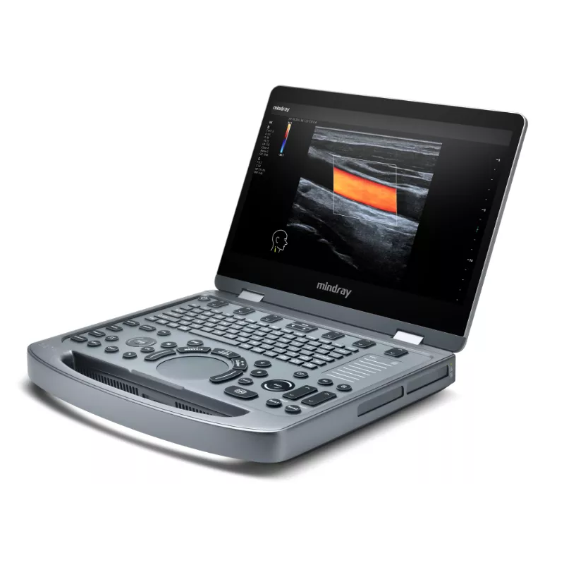 Ecógrafo MX3S